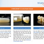 Răng sứ HT – Smile