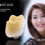 Phân loại vật liệu sứ trong nha khoa